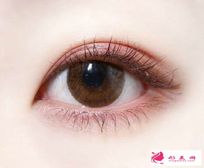 開眼角手術幫你告別“瞇瞇眼”