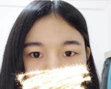 上海九院開雙眼皮誰做的好？楊群案列分享