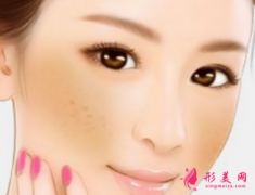 懷孕長黃褐斑可以做激光治療嗎？