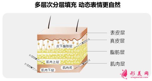 大腿抽脂填充臉部手術(shù)風險有哪些？
