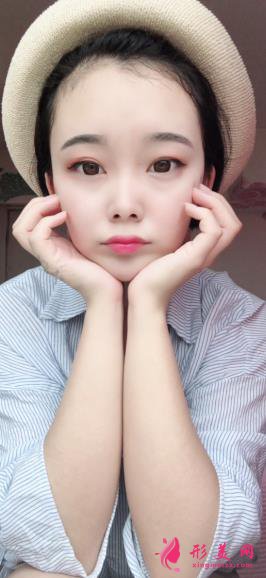 手術過程