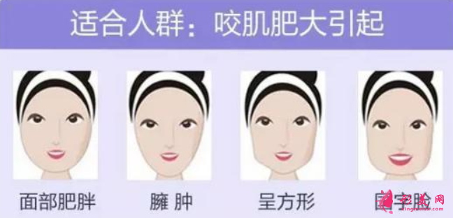 瘦臉針是怎么打的