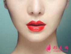假體隆下巴后會面部僵硬嗎？