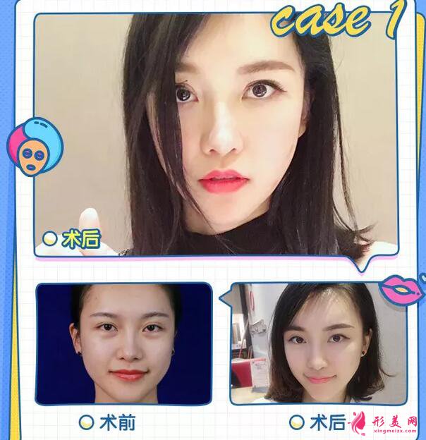 黑臉娃娃可以維持多久?