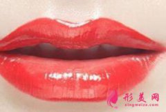 上海整形醫(yī)院唇裂修復(fù)修復(fù)的類型