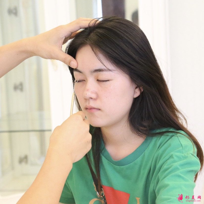 深圳利美康西一諾整形醫(yī)院隆鼻案例
