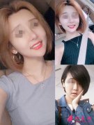 沈陽(yáng)協(xié)和整形美容醫(yī)院隆鼻怎么樣？案例+價(jià)格表分享