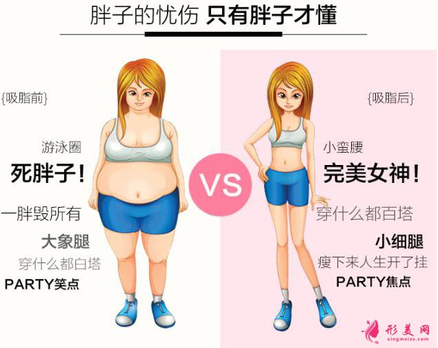 吸脂減肥的價(jià)格