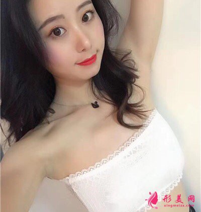 南京韓辰潘青青醫(yī)生真人案例 隆胸60天前后對(duì)比圖分享