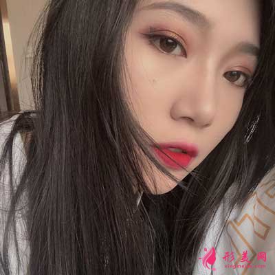 雅美整形趙世華為我做的鼻子 術(shù)后第40天效果真的很不錯