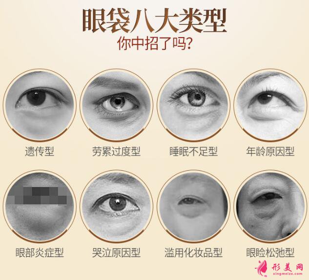 內(nèi)切祛眼袋效果怎么樣?