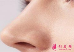 鼻尖整形手術(shù)特點(diǎn)到底是什么？