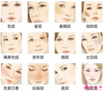 激光祛斑會(huì)出血嗎？