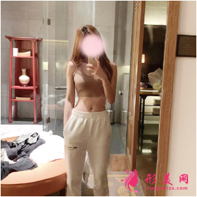 深圳富華斯良洪做腰腹部吸脂怎么樣？90天效果對(duì)比真的很棒