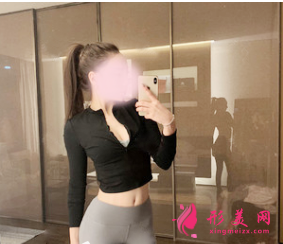 深圳富華斯良洪做腰腹部吸脂怎么樣？90天效果對(duì)比真的很棒