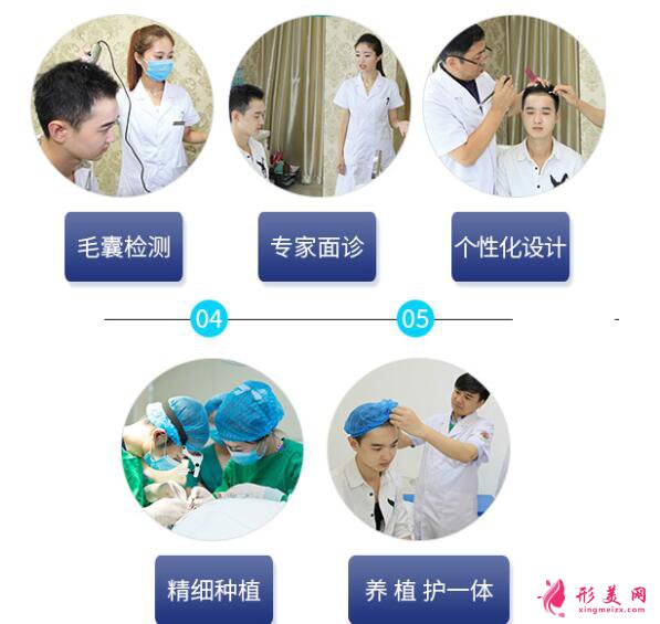 種植頭發(fā)靠譜嗎？