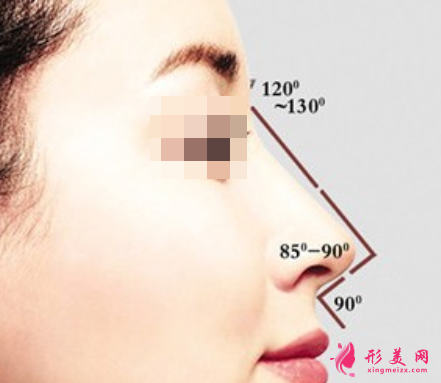假體隆鼻會(huì)排異嗎