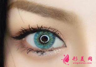 上海開眼角手術(shù)后會傷害眼晴嗎