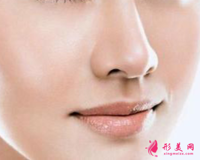 隆鼻手術(shù)后的護(hù)理注意事項(xiàng)