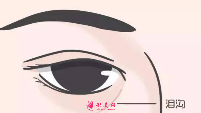 淚溝填充價格