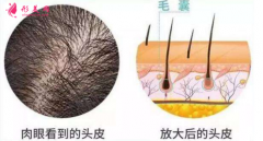 格萊美醫(yī)療美容種植頭發(fā)需要多少錢？注意事項要注意啦！