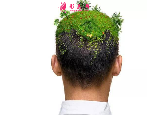 種植頭發(fā)需要多少錢