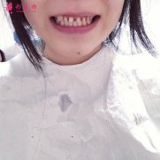 廣州德倫口腔牙齒整形怎么樣？牙齒這一家人就應(yīng)該整整齊齊的