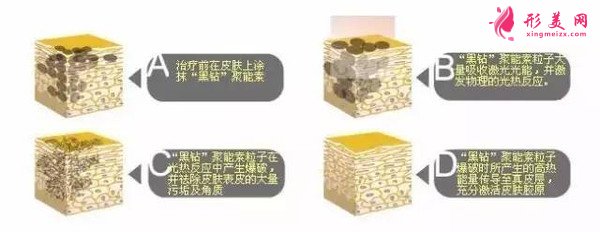 做黑臉娃娃費(fèi)用多少