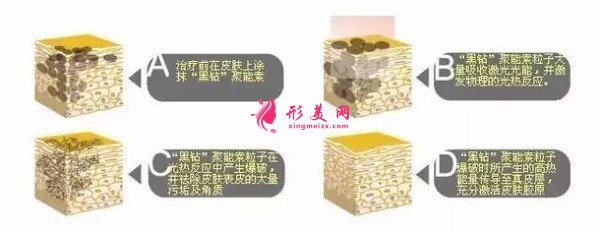 做黑臉娃娃費(fèi)用多少