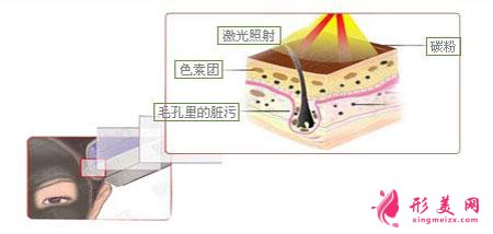 做黑臉娃娃費(fèi)用多少