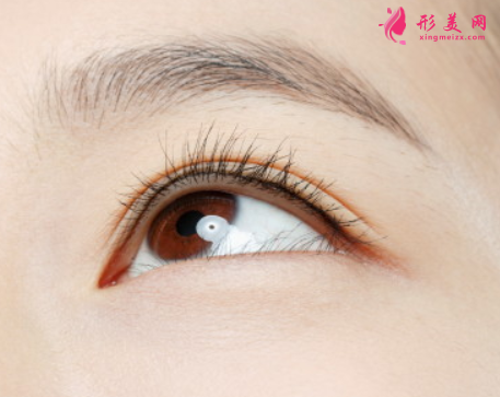 做埋線雙眼皮的優(yōu)勢(shì)