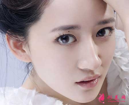杭州割雙眼皮效果怎么樣?大概需要多少錢?