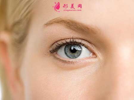 杭州割雙眼皮效果怎么樣?大概需要多少錢?