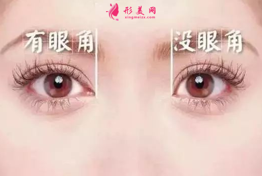 開眼角 (4).png
