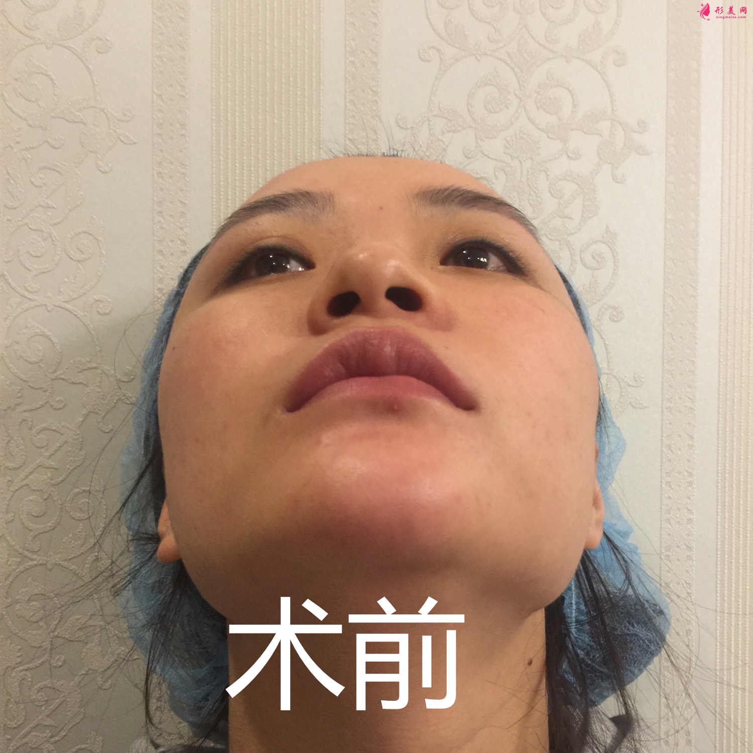 深圳赫思醫(yī)療美容怎么樣？價目表及網(wǎng)紅鼻整形案例