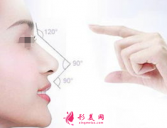 假體隆鼻包膜攣縮要取出嗎？