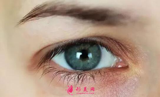 哪種雙眼皮手術(shù)的實際效果長久?