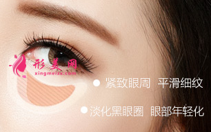 內(nèi)切祛眼袋多久恢復(fù)自然