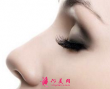 自體肋軟骨隆鼻多久恢復(fù)自然