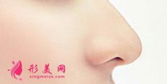 鼻翼縮小手術(shù)的疤痕是怎么處理的
