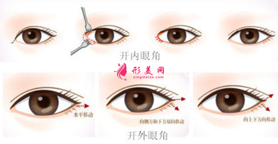 開內(nèi)眼角和開外眼角有什么區(qū)別