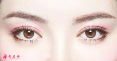 開內(nèi)眼角和開外眼角有什么區(qū)別？