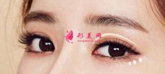 埋線雙眼皮一般需要多少錢？