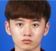 上海美萊醫(yī)學(xué)美容醫(yī)院歐陽(yáng)春做鼻綜合整形好不好？附上術(shù)后感受分