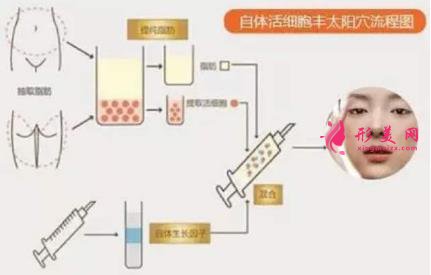 局部腫脹
