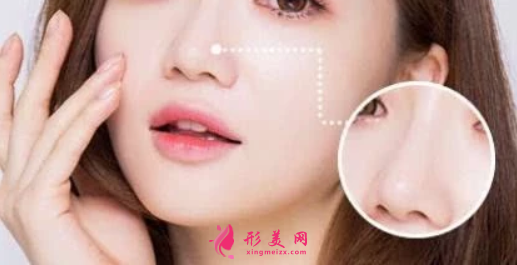 鼻翼縮小手術(shù)出血多嗎