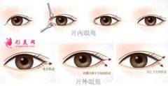 開眼角失敗怎么辦?有沒有比較好的修復(fù)辦法?