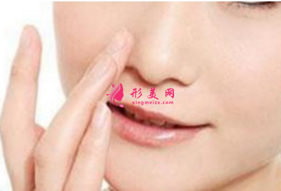 做鼻翼縮小整形要多少錢