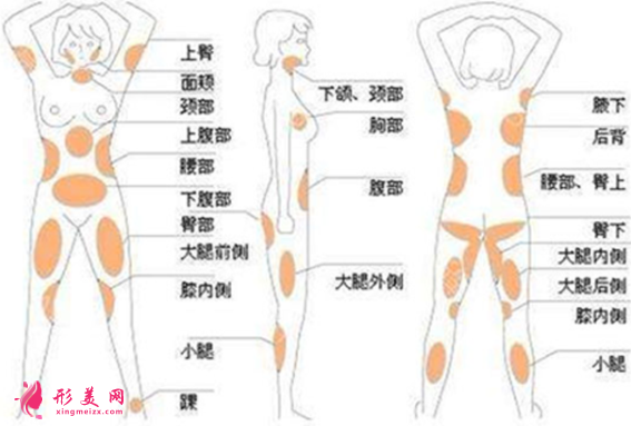 吸脂減肥一次可以減掉多少脂肪