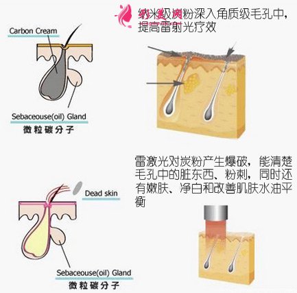 做黑臉娃娃哪里好
